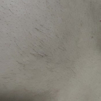 Liparis Güzellik Salonu'nda Hayal Kırıklığı