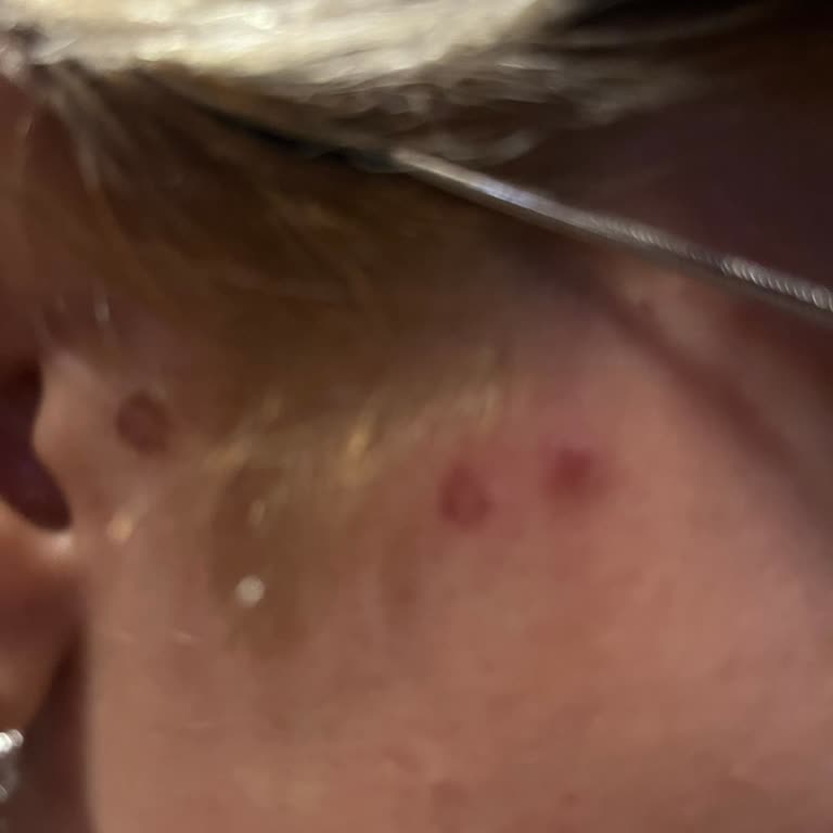 Palette Saç Dibimde Yaralar Var