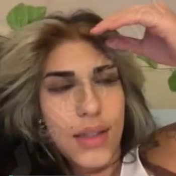 Palette Saç Dibimde Yaralar Var