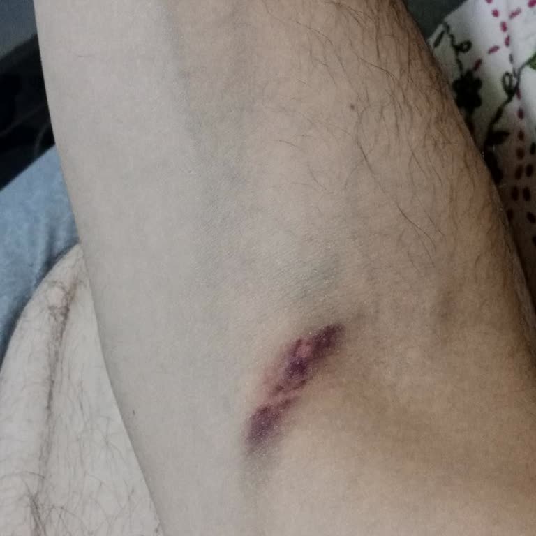 Umut Polikliniği (Afyonkarahisar) Tedaviden Memnun Kalmadım!