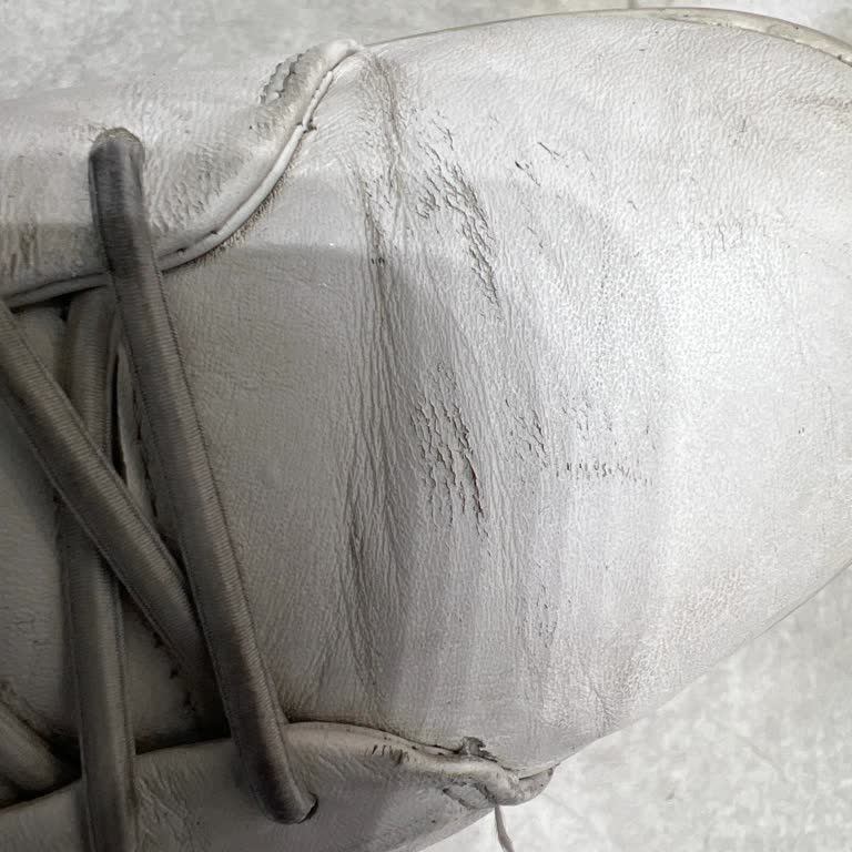 Ayakkabıda Deformasyon Ve İletişim Sorunu