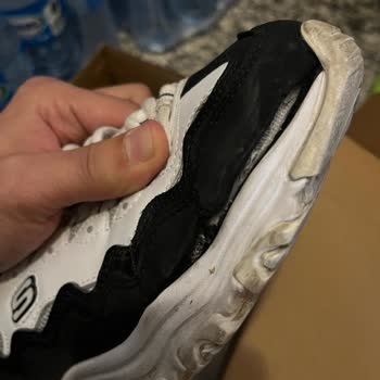 Skechers Ayakkabıda Garanti Süresi Dolmadan Çözülmeyen Sorun