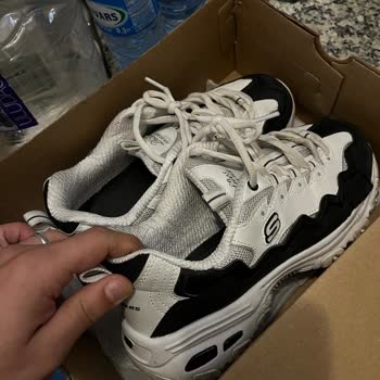 Skechers Ayakkabıda Garanti Süresi Dolmadan Çözülmeyen Sorun