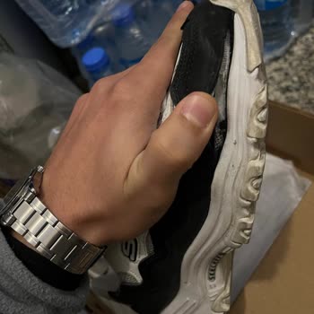 Skechers Ayakkabıda Garanti Süresi Dolmadan Çözülmeyen Sorun