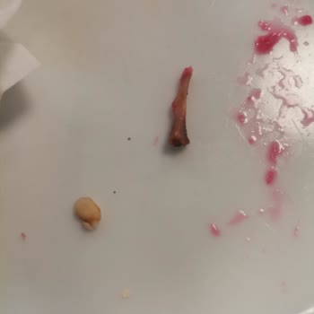 Yemekhanede Yaşanan Tehlikeli Durumlar Ve İlgisizlik