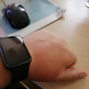 Sephora El Maskesi Alerjik Reaksiyon Yarattı