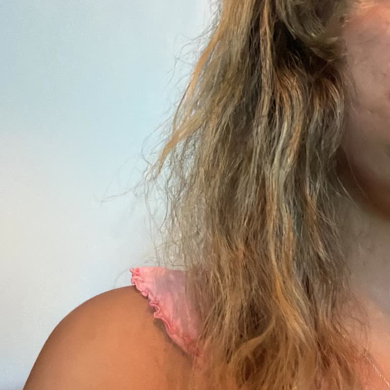 Keratin Bakımında Hayal Kırıklığı Ve İletişim Sorunları