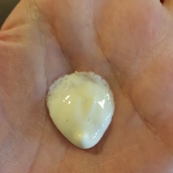 Bioderma Bozuk Güneş Kremi Yüzümde Kalıcı Hasar Bıraktı