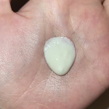 Defne Eczanesi (Elazığ) Alınan Ürün Bozuk Çıktı!