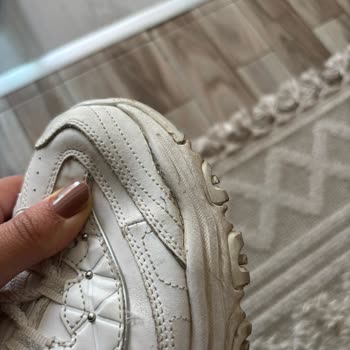 Skechers Ayakkabıda Beklenmedik Deformasyon Ve Kalite Sorunu
