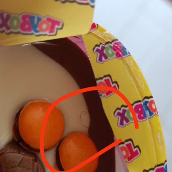 Toybox Sürpriz Yumurta İçinden Çıkan Hijyen Skandalı