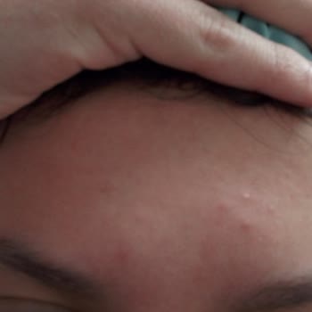 Yoğun Tavsiyeyle Alınan Güneş Kremi Hayal Kırıklığı Yarattı