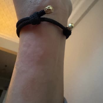 Alerji Yapan Bileklik Sorunu