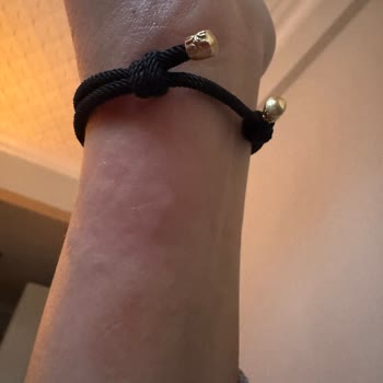 Alerji Yapan Bileklik Sorunu