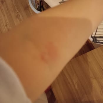 Kolan Hastanesi'nde Kan Alma Sorunu Ve Yetersiz Sağlık Personeli