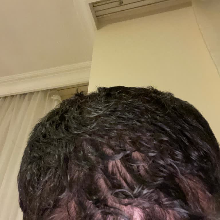 Esteworld Eksik Bilgilendirme Ve İade Sorunu