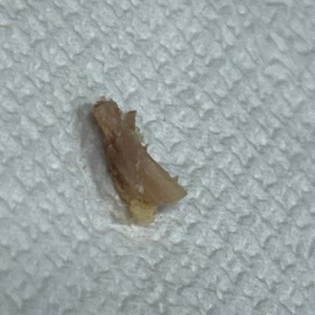 Dardanel Ürünü İçinde Tavuk Tırnağı Ve Kemik Şoku