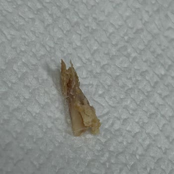 Dardanel Ürünü İçinde Tavuk Tırnağı Ve Kemik Şoku