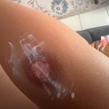 Özel Ankara Life Polikliniği Profesyonellikten Uzak Hizmet Ve İlgisizlik!