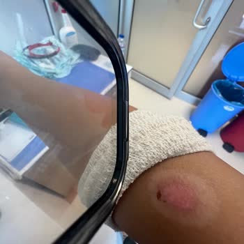 Özel Ankara Life Polikliniği Profesyonellikten Uzak Hizmet Ve İlgisizlik!