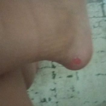 Nine West Ayakkabının Rahatsız Edici Topuk Sorunu