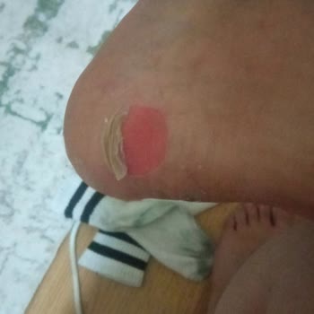 Nine West Ayakkabının Rahatsız Edici Topuk Sorunu