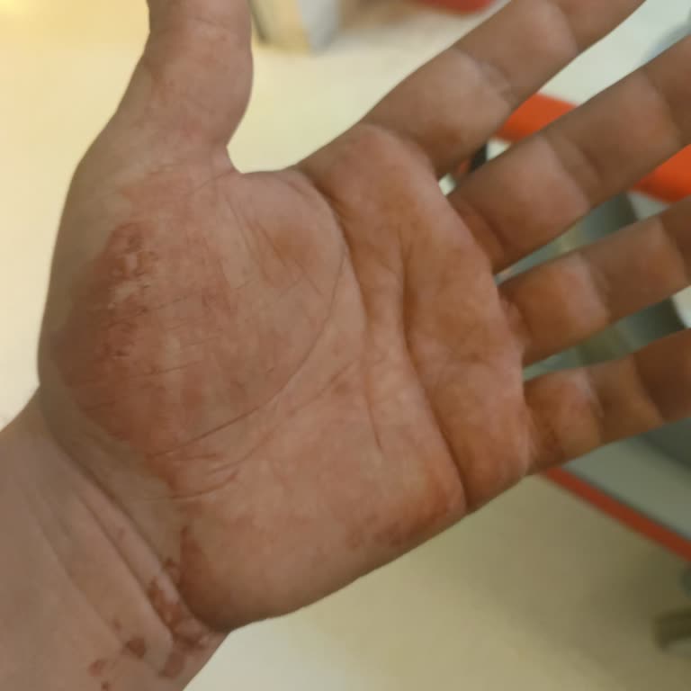 Antalya Eğitim Araştırma Hastanesi Yetersiz Tedavi Ve İhmal