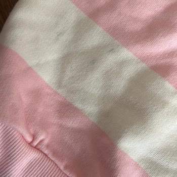 Lekeli Ürün Ve Yetersiz Müşteri Hizmeti