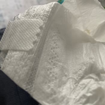 Baby Turco Bebek Bezi Sızıntı Sorunu