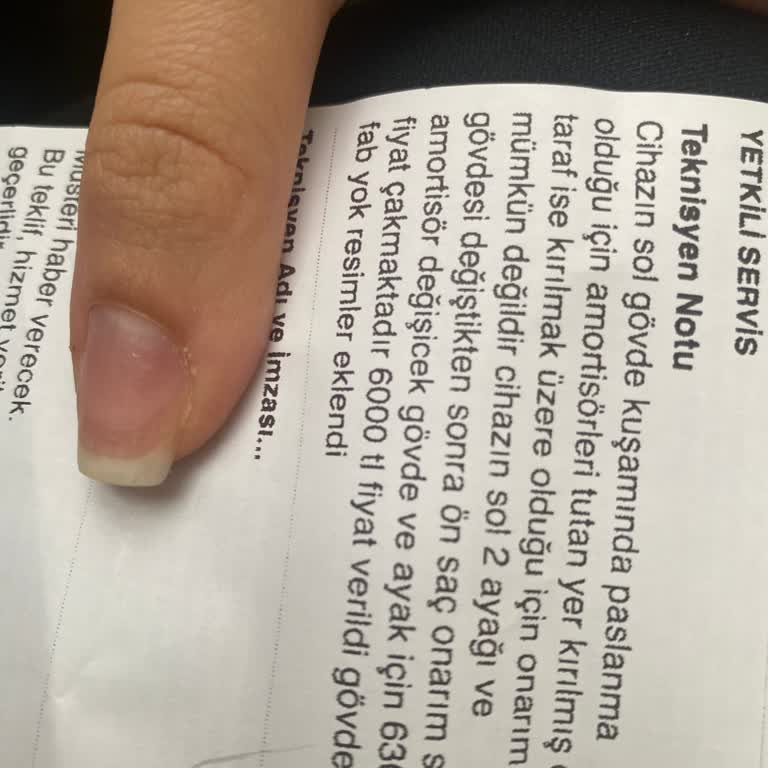 Bosch Çamaşır Makinesi Garanti Sorunu Ve Ek Ücret Talebi