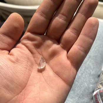 Kuruyemiş Paketinden Cam Parçası Çıkması