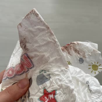 Kalitesiz Bebek Bezi Deneyimi