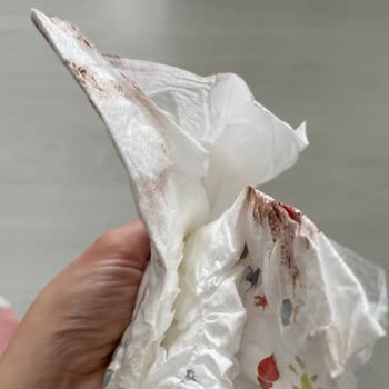 Kalitesiz Bebek Bezi Deneyimi