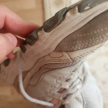 Skechers Ayakkabıda Beklenmedik Yıpranma Ve Olumsuz Müşteri Deneyimi