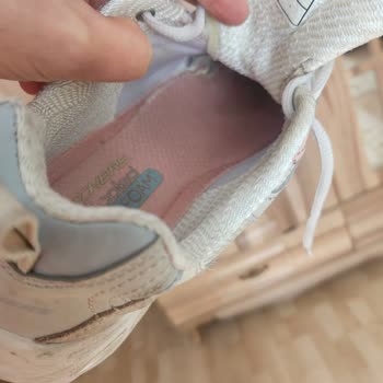 Skechers Ayakkabıda Beklenmedik Yıpranma Ve Olumsuz Müşteri Deneyimi