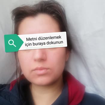 Yüz Maskesi Kızarıklık Ve Yanma Sorunu