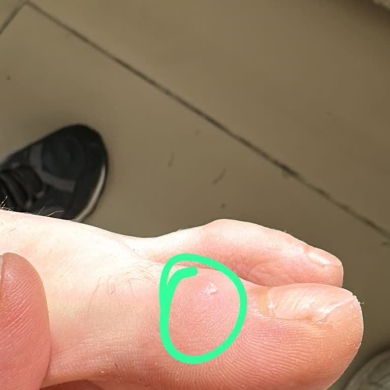 Çocuğumun Ayakkabısı İlk Gününde Sorun Çıkardı