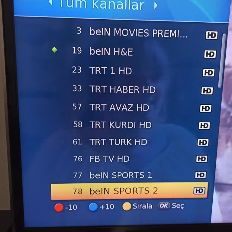 Digiturk Teknik Servis Ücretleri Ve Mağduriyet