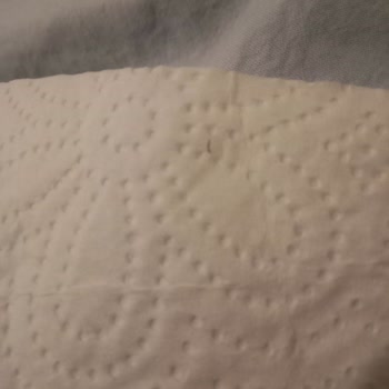 Selpak Kağıt Havluda Beklenmedik Kıl Problemi