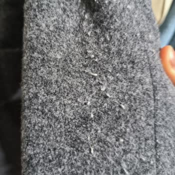 Koton'un Kalitesiz Kabanı Müşteriyi Hayal Kırıklığına Uğrattı