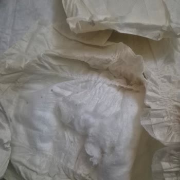 Hatalı Bebek Bezleri Ve Mağduriyet