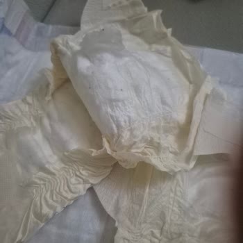 Hatalı Bebek Bezleri Ve Mağduriyet