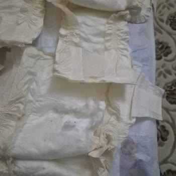 Hatalı Bebek Bezleri Ve Mağduriyet