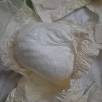 Hatalı Bebek Bezleri Ve Mağduriyet