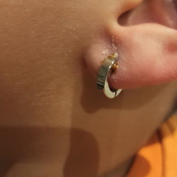 Uzak Işıklar Mağazasından Alınan Küpeler Sağlık Sorunlarına Yol Açtı