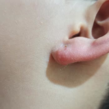 Uzak Işıklar Mağazasından Alınan Küpeler Sağlık Sorunlarına Yol Açtı