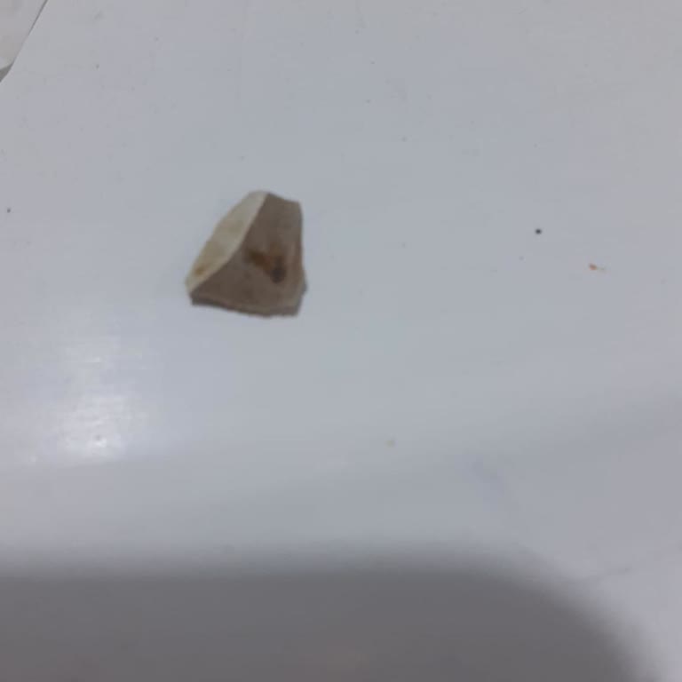 Dürüme Gizlenmiş Tehlike: Oğlumun Hayatını Kurtardım!