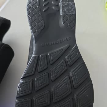 Skechers Ayakkabı İadesinde Zorluk Ve Sağlık Sorunları