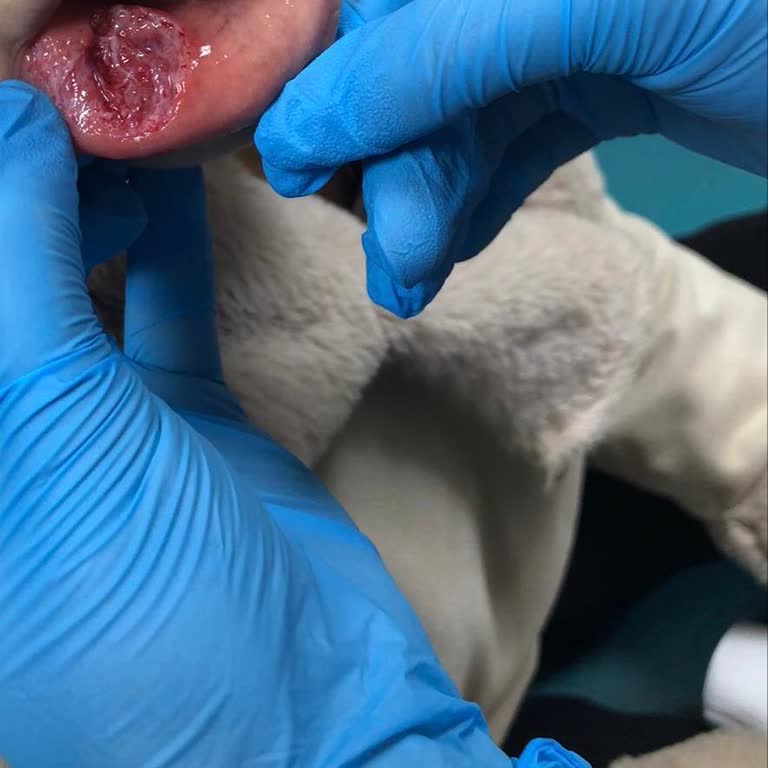 Selenay Tıp Merkezi Kanal Tedavisi Sonrası Yaşanan Büyük Sorunlar