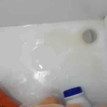 Arçelik Dondurucu: Garanti Sonrası Sorunlar Ve Yetersiz Servis